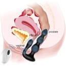 RemoteSilikonowy Analbeads - 6