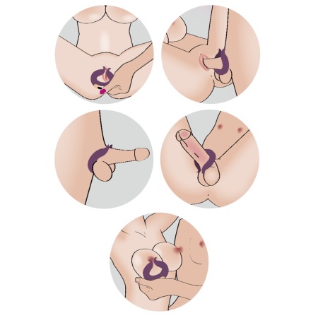 Wibrator pierścieniowy Couples Choice Two Motors Coup z 2 silnikami i elastycznymi ramionami, długość 8,7 cm - 2