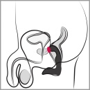 Wibrator prostaty Rebel Prostate Plug recharge – elastyczna konstrukcja z zakrzywioną głowicą i stymulatorem krocza, 9 trybów, d - 8